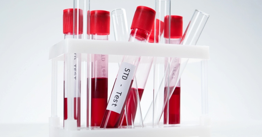 Tests des infections sexuellement transmissibles (IST)