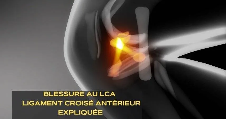 Blessure au LCA - Ligament croisé antérieur - Expliquée