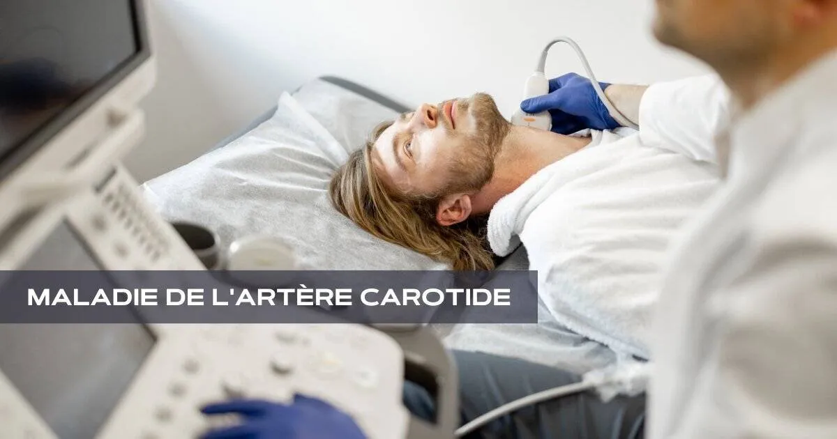 Maladie de l'artère carotide