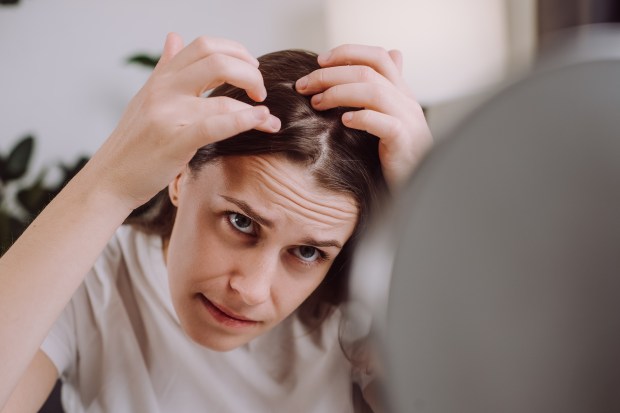 Femme inquiète de perdre ses cheveux