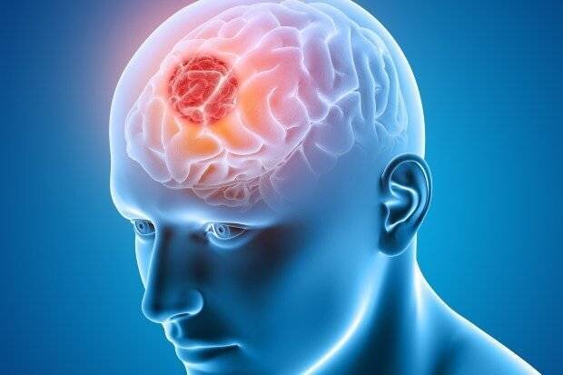Symptômes des tumeurs cérébrales