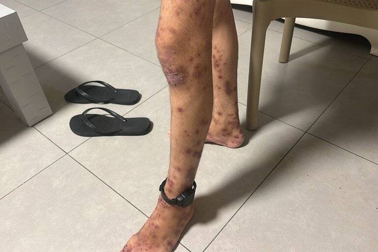 Bracelet électronique d'Eyad malgré sa maladie.