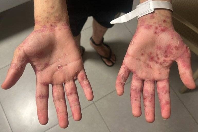 Conditions de vie des prisonniers.