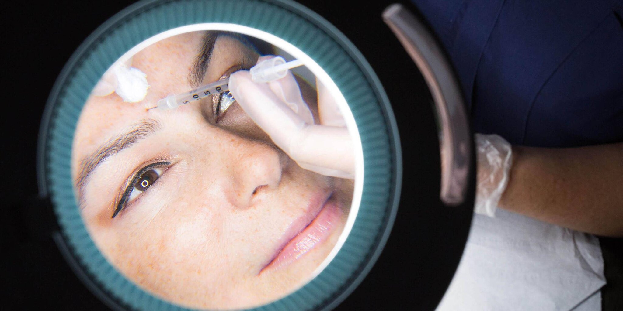 Une femme reçoit une injection de Botox.