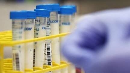 Des échantillons de lait potentiellement contaminés, aux Etats-Unis, le 10 décembre 2024. (MICHAEL M. SANTIAGO / GETTY IMAGES NORTH AMERICA / AFP)