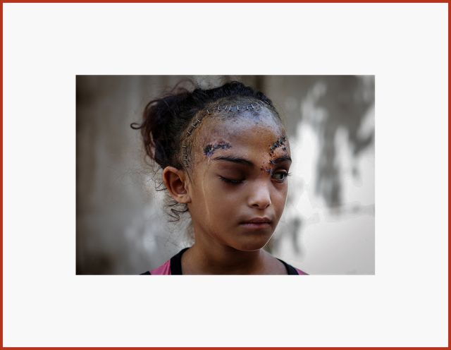 Témoignage de la guerre à Gaza