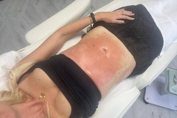 Traitements esthétiques pour ventre plat