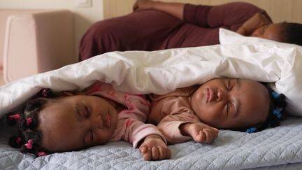 Sœurs siamoises en Côte d'Ivoire, séparées par une opération