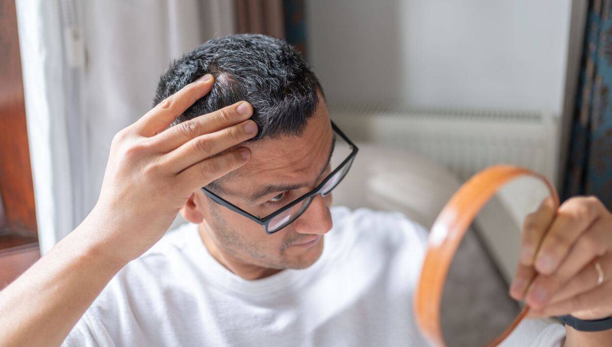 Qu’est-ce que la teigne du cuir chevelu ?