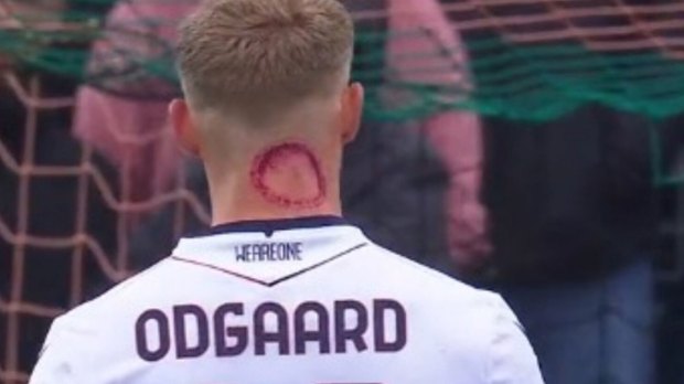 Jens Odgaard avec une blessure au cou