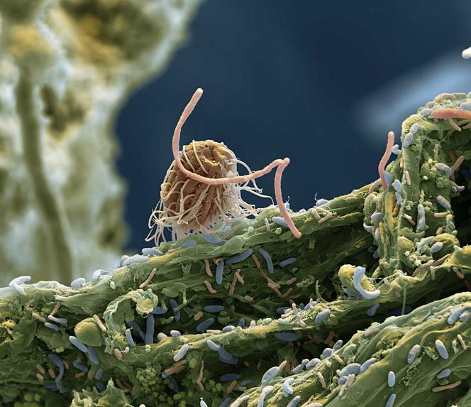 Photographie au microscope électronique à balayage colorisée de micro-organismes dans un échantillon de sol humide. Au centre, on voit un protozoaire cilié auquel adhère une bactérie.