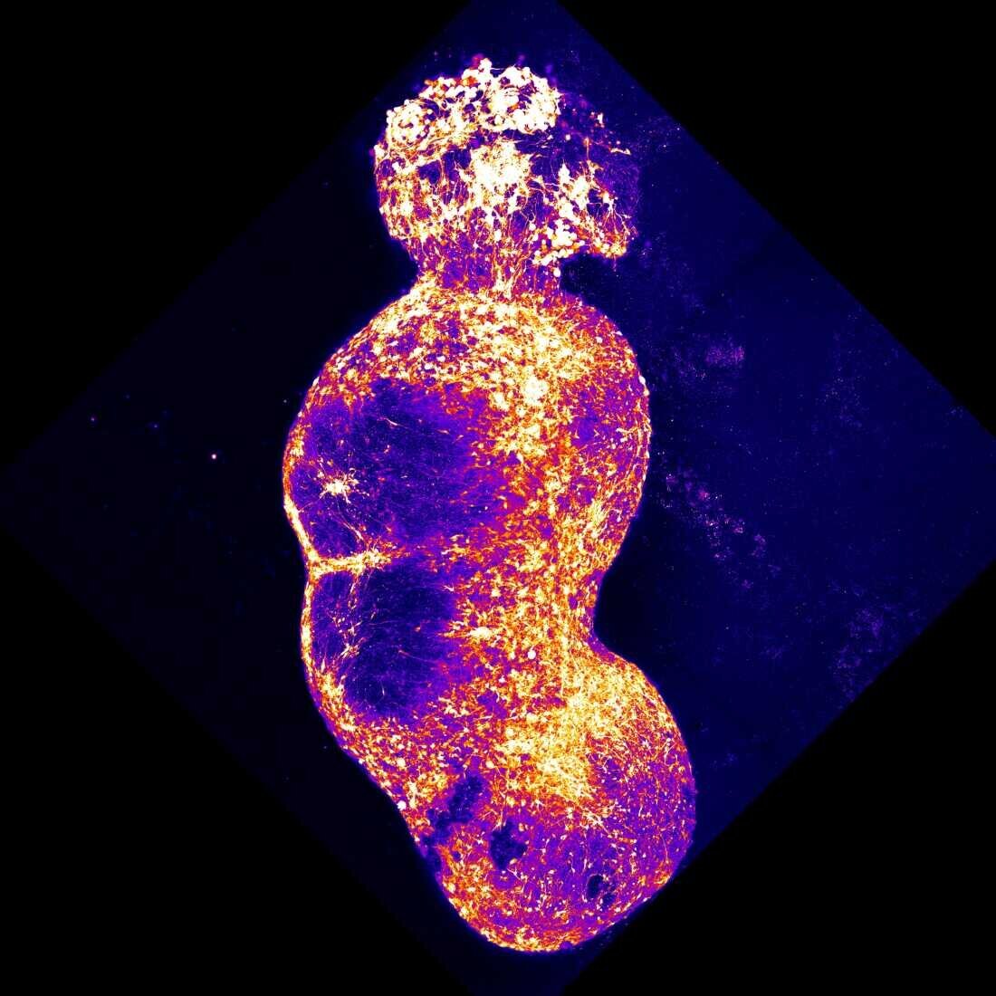 Les chercheurs ont créé un assembloid en intégrant quatre organoïdes représentant les quatre composants du chemin sensoriel humain.