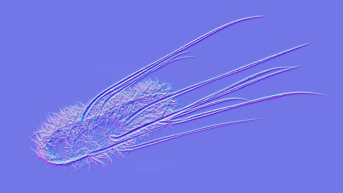 Escherichia coli, une bactérie courante dans l'intestin humain, libère une toxine liée à certains cas de cancer colorectal.
