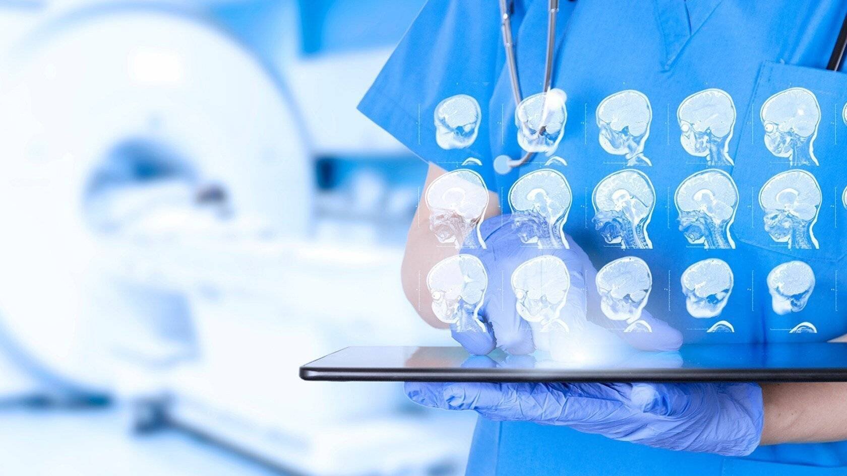 Radiologue examine des scanners cérébraux d'enfant