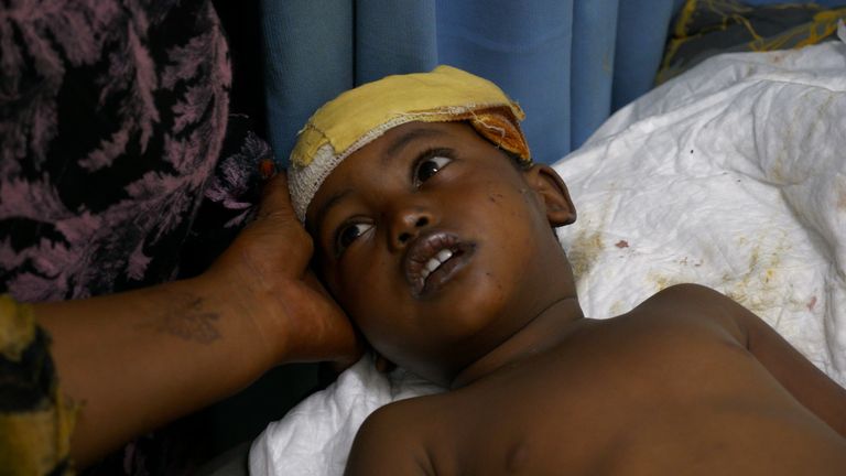 Enfants blessés dans un hôpital à Atbara, Soudan