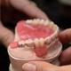 Aligneur dentaire transparent et rétraction gingivale