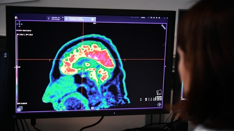 Un scanner du cerveau. Photo d'illustration - Fred Tanneau - AFP