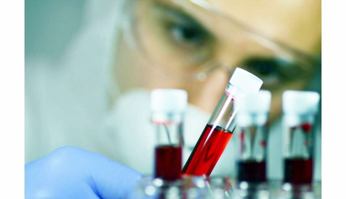 Chercheurs français présentant la découverte du nouveau groupe sanguin