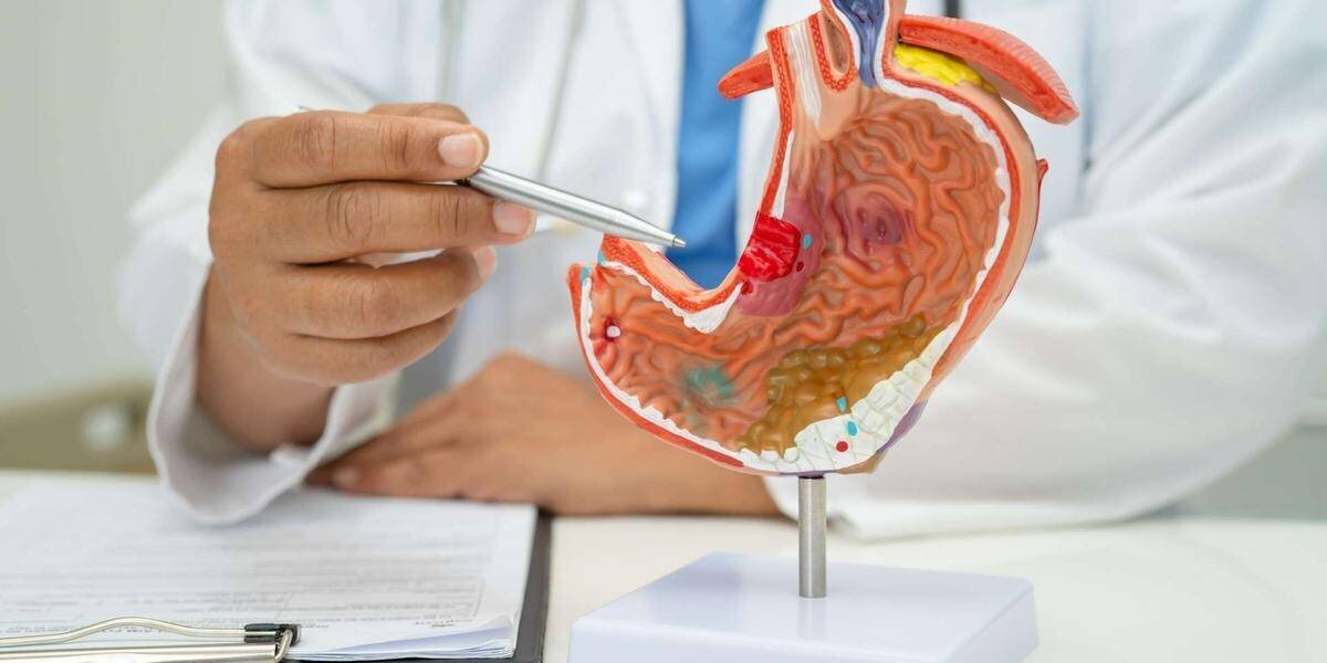 Campagne de dépistage du cancer gastrique