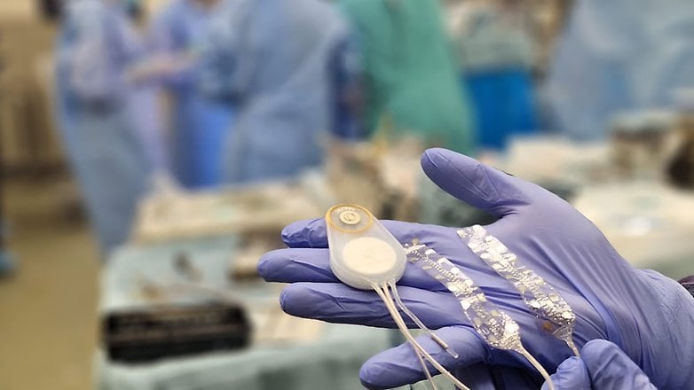 Une main dans un gant chirurgical tient le dispositif Brain Interchange System de CorTec dans un cadre médical.