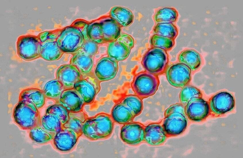 Tours de refroidissement liées à la légionellose à New York