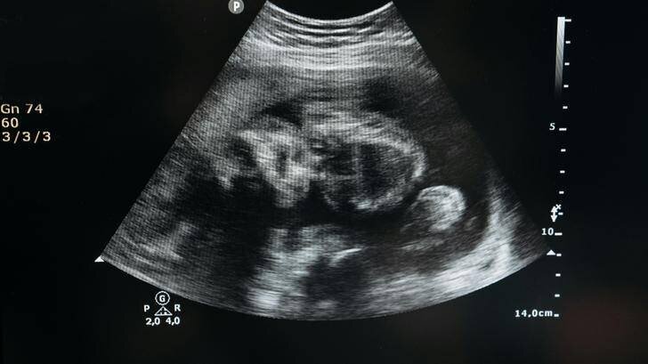 Révélation de genre avec gâteau et famille