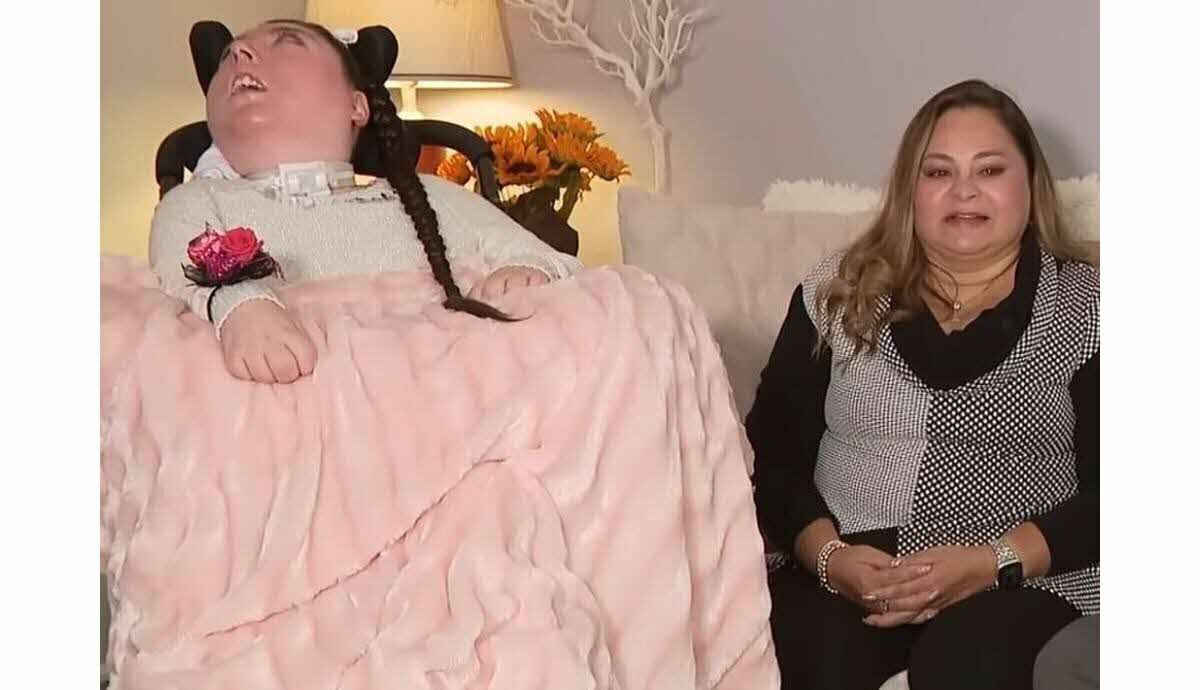 Jeune Américaine née quasi sans cerveau, image médicale