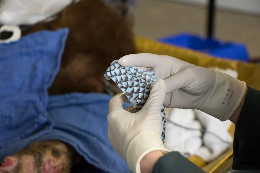 La guérison d'Eliana grâce à la peau de poisson : un espoir