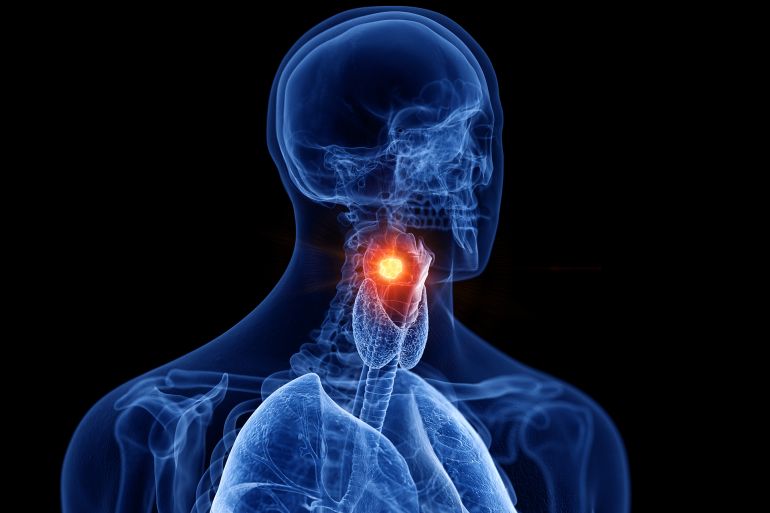 Illustration médicale du larynx