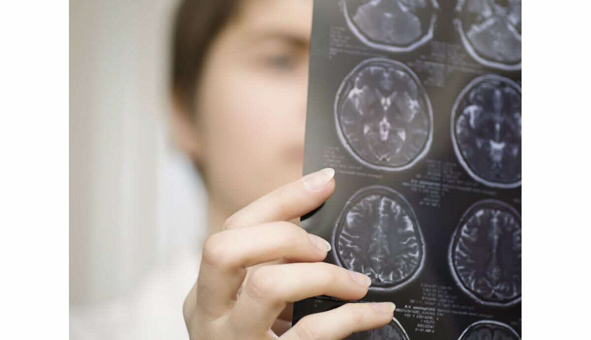 Point d'inflexion du cerveau à 32 ans