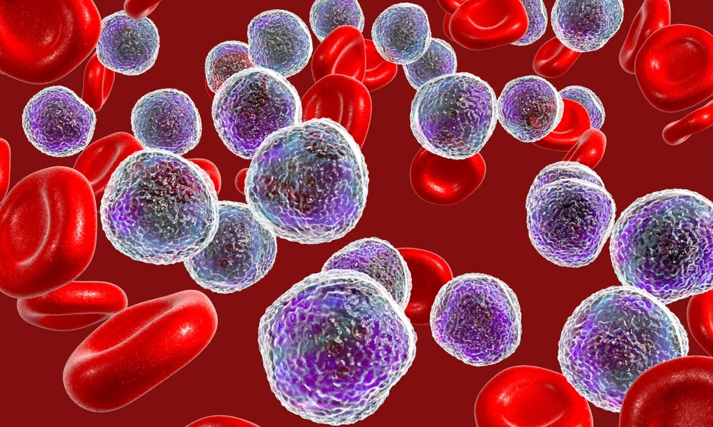 Nouveau traitement sans chimio révolutionne la leucémie lymphoïde chronique