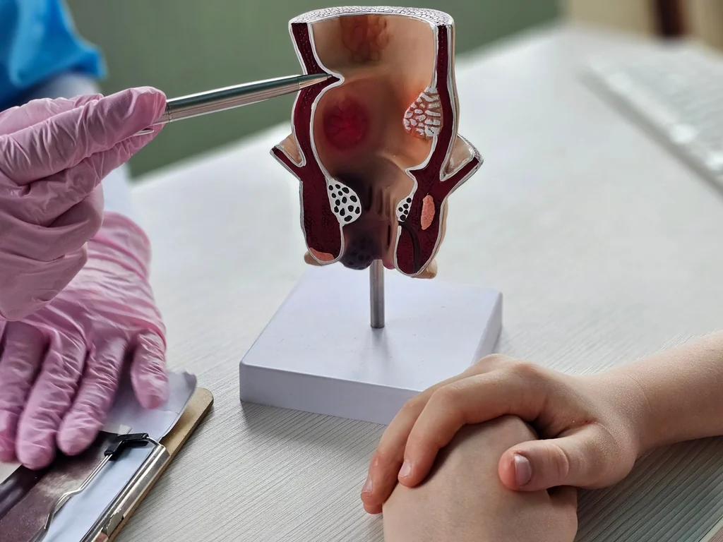 Hémorroïdes : quand la chirurgie devient nécessaire