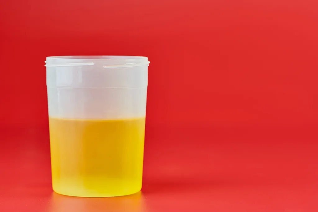 Couleur de l'urine : que révèle votre pipi sur votre santé ?