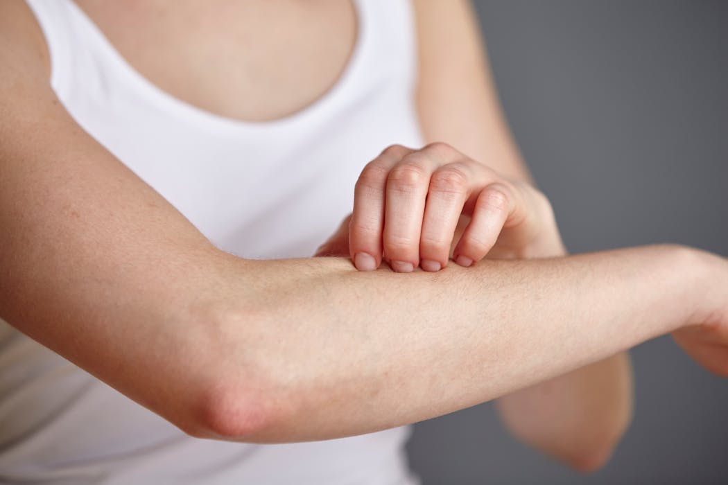 Personne se grattant l'avant-bras avec la main droite, portant un débardeur blanc
