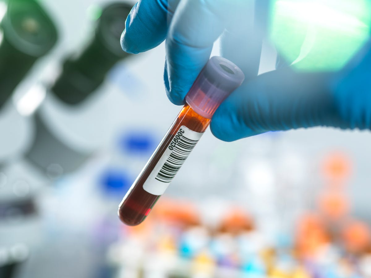 Pourquoi analyser vos plaquettes sanguines est essentiel pour votre santé